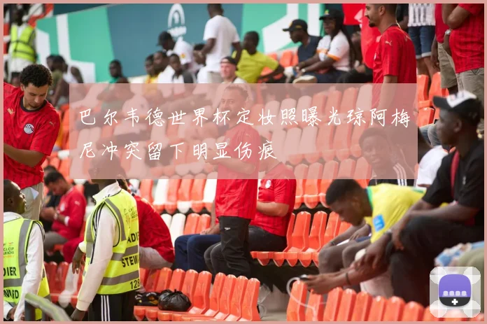 巴尔韦德世界杯定妆照曝光琼阿梅尼冲突留下明显伤痕